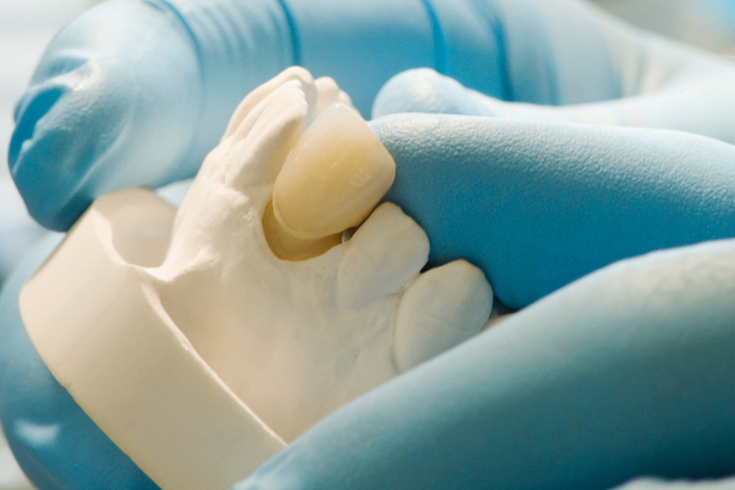 Central Dent Clinic Fogpótlás