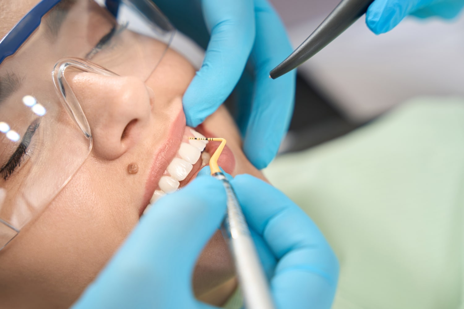 Central Dent Clinic Parodontológia